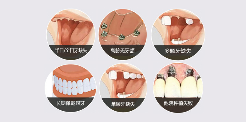 吊旗背面60-40CM
